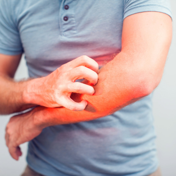 Hilfe bei Neurodermitis & Schuppenflechte: Warum die Salzkabine ein Gamechanger für Deine Haut ist